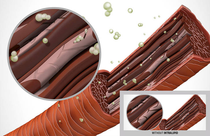 csm DS RichRepair Technology INTRALIPID fb423d3cf4
