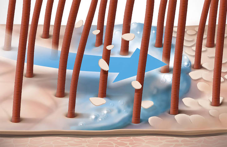 csm DS ScalpSpecialist Technology Octopirox Zinc Pyrithione 888c518425