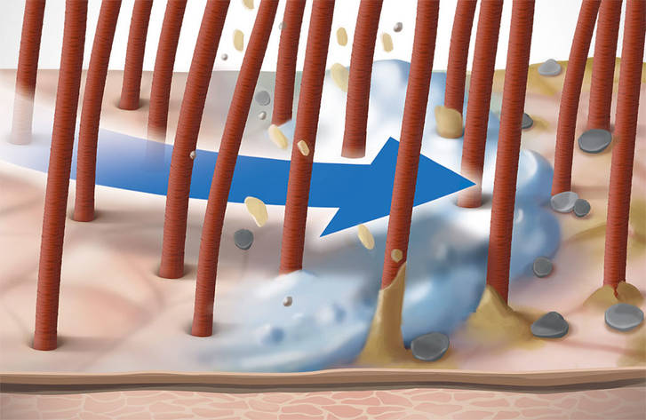 csm DS ScalpSpecialist Technology Zinc PCA 75c9e1f8a4